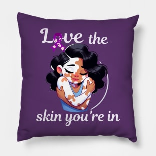 Love The Skin You're In Vitiligo Awareness and Acceptance Pillow