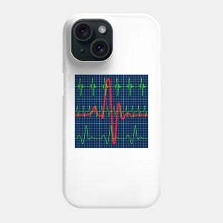 Cardiogram charts pattern Phone Case