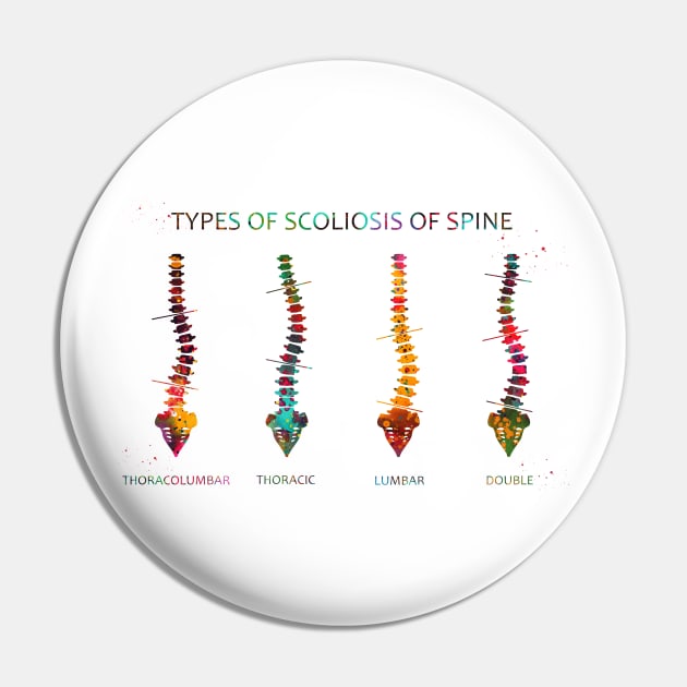 Type of scoliosis of spine Pin by erzebeth