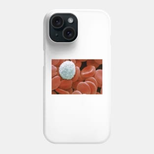 Colour SEM of red & white blood cells (P242/0218) Phone Case