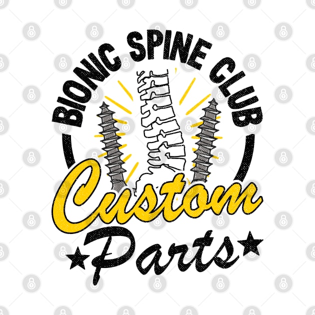 Bionic Spine Club Custom Parts Surgery Spinal Fusion Get Well by Kuehni