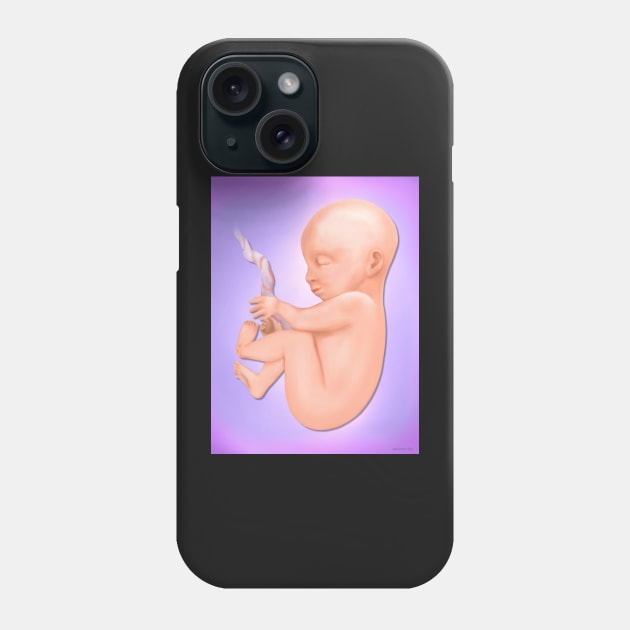 Fetus 7 Months Phone Case by SpiceTree