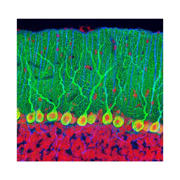 Purkinje nerve cells in the cerebellum (P360/0474) by SciencePhoto