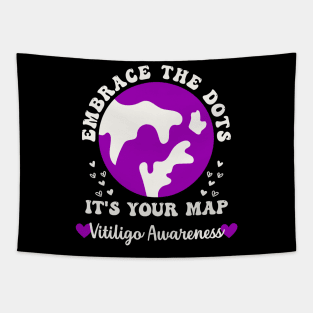 Vitiligo Awareness Embrace the Dots Vitiligo Acceptance Tapestry