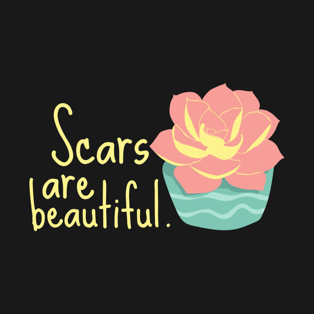 Scars are Beautiful Sad Shirt Mental Health Shirt Encouragement Shirt Love Motivational Inspirational Shirt Positivity Funny Sarcastic Cute Shirt Yoga Meditation Happy Spiritual Depression Anxiety Cancer Autism Awareness Gift by EpsilonEridani