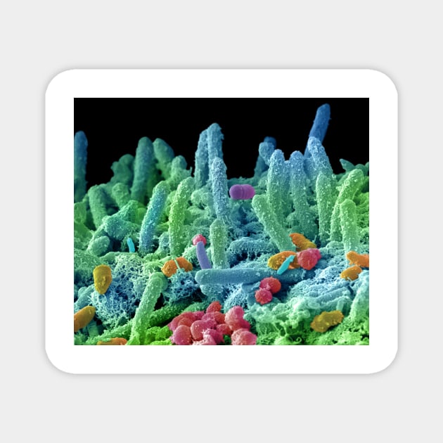 Oral bacteria, SEM (C029/3194) Magnet by SciencePhoto