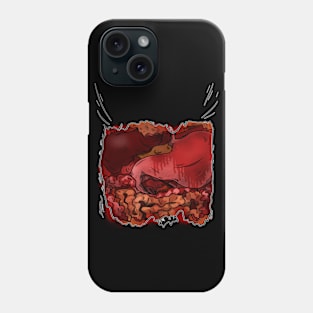 Zombie insides costume Phone Case