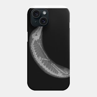 Banana X-ray (NO text) Phone Case