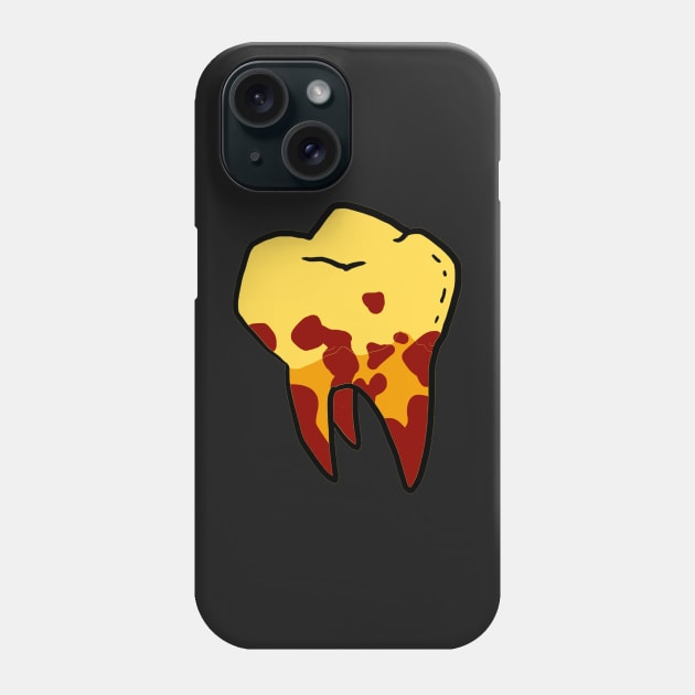 Teeth popping pattern Phone Case by KO-of-the-self