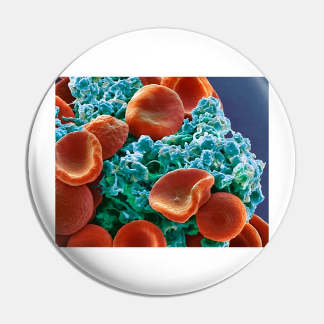 Red blood cells and platelets, SEM (C029/3211) Pin by SciencePhoto