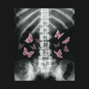 Xray Skeleton Pink Butterfly Egirl y2k Harajuku Dark Grunge T-Shirt