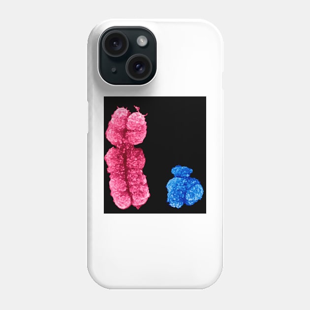 X and Y chromosomes (C003/0729) Phone Case by SciencePhoto