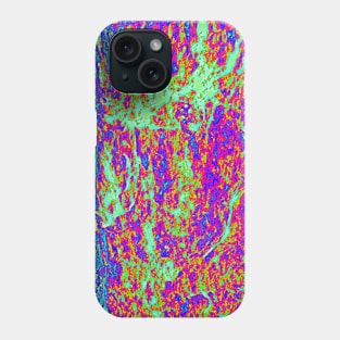 Digital hot rock inversion Phone Case