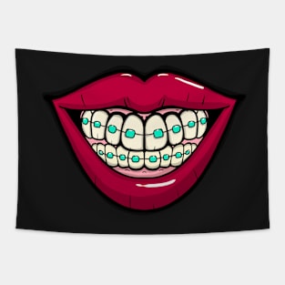 Big Smile with braces Tapestry