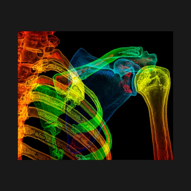 Normal shoulder, 3D CT scan (C029/5201) by SciencePhoto