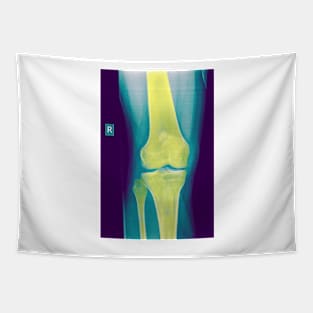 Knee x-ray (C022/3104) Tapestry