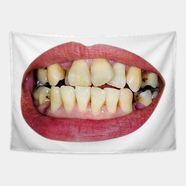 damaged teeth Tapestry by Sauher