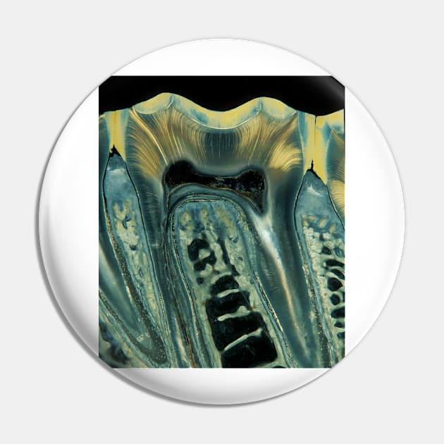 Tooth, light micrograph (C028/6621) Pin by SciencePhoto