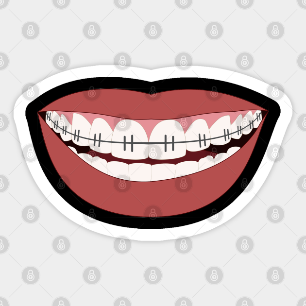 Smile With Braces - Teeth Mask - Sticker | TeePublic Smile With Braces - Teeth Mask - Sticker | TeePublic