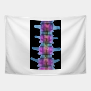 Lumbar spine, X-ray (P116/0393) Tapestry