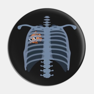 Nemo Thorax (Pneumothorax) Pin