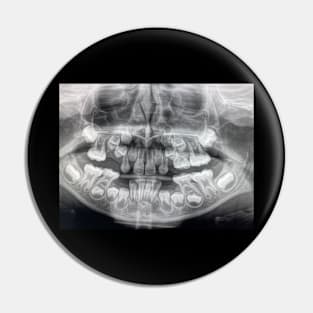 Dental x ray Pin