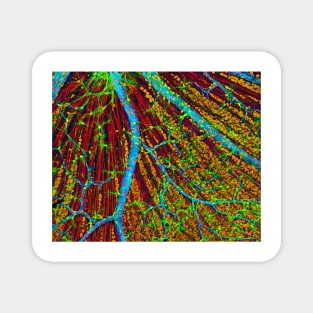 Retina blood vessels and nerve cells (P424/0244) Magnet