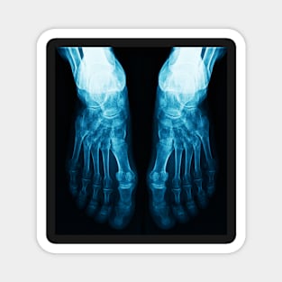 X-Ray Feet Magnet