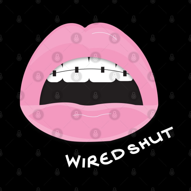 Wired Shut Logo White Font by wiredshutpodcast