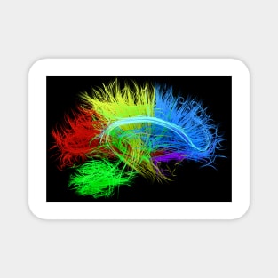 Human brain nerve tracts, illustration, (F035/7627) Magnet