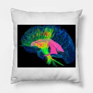 Brain fibres, DTI MRI scan (C017/7036) Pillow