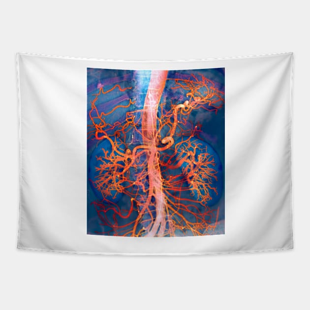 Abdominal arteries, X-ray (P206/0309) Tapestry by SciencePhoto