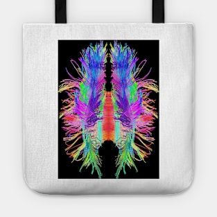 White matter fibres and brain, artwork (C015/1934) Tote