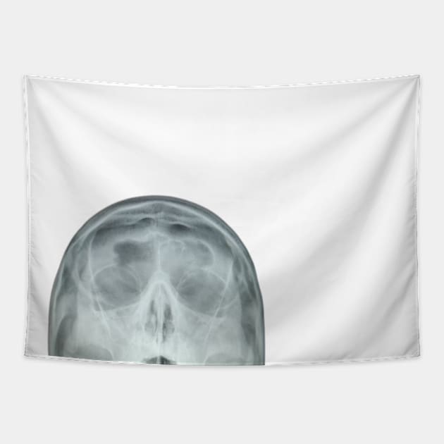 my head x-ray Tapestry by Anthony88