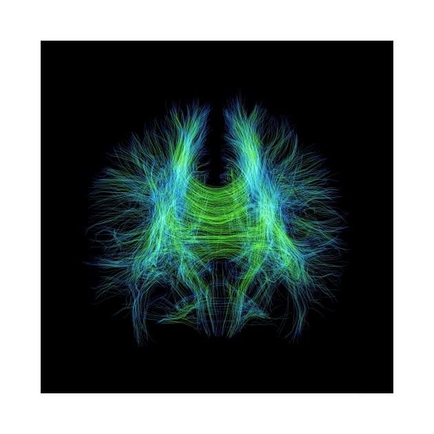 Brain fibres, DTI MRI scan (C017/7099) by SciencePhoto