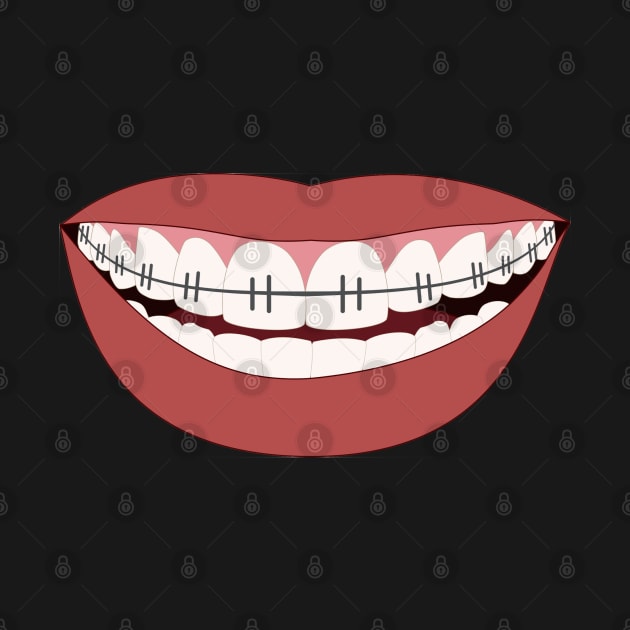 Smile With Braces by Ndigwan Designs