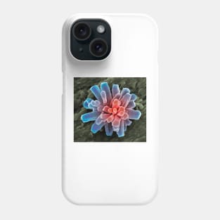 Calcium phosphate crystal, SEM (A600/0865) Phone Case