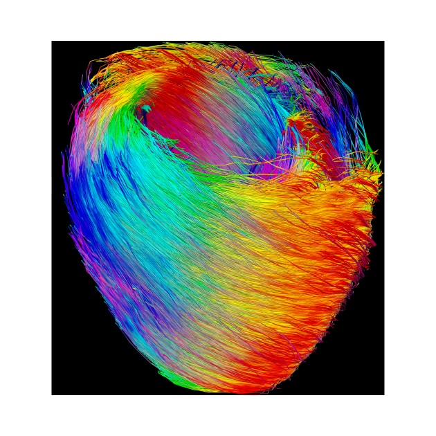 Heart muscle fibres, DTI scan (C021/5126) by SciencePhoto