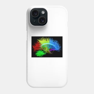 Human brain nerve tracts, illustration, (F035/7627) Phone Case