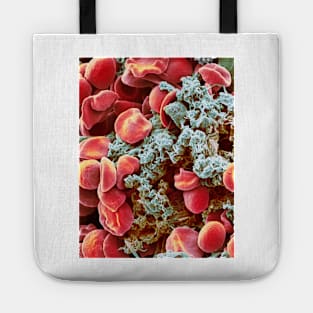 Red blood cells and platelets, SEM (F013/1526) Tote