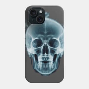 X-ray skull Phone Case