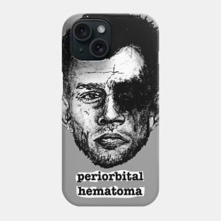 Periorbital Hematoma Phone Case