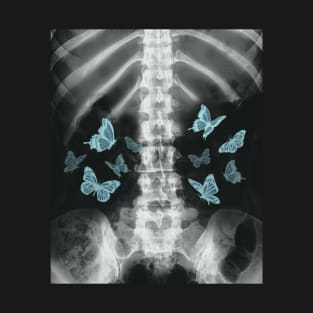 Xray Skeleton Blue Butterfly Egirl y2k Harajuku Dark Grunge T-Shirt