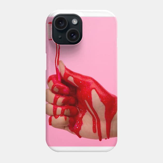 Because You Don't Floss Phone Case by AllenEggy