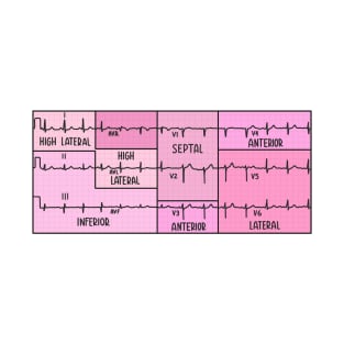 Hand Drawn Electrocardiogram (ECG) Pink T-Shirt