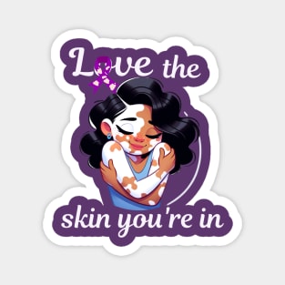 Love The Skin You're In Vitiligo Awareness and Acceptance Magnet