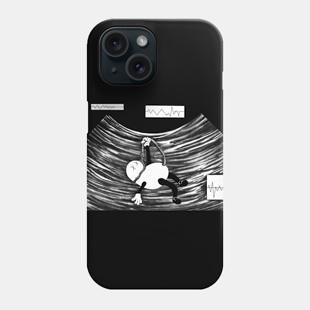 Fetus-The right to live & die. Phone Case by Nonnutritive Art