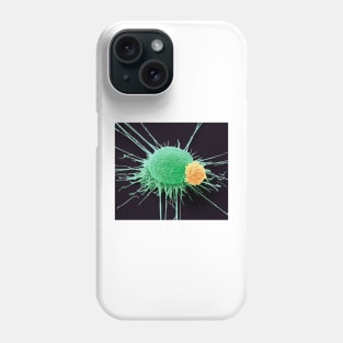 T lymphocyte and cancer cell, SEM (C022/6435) Phone Case