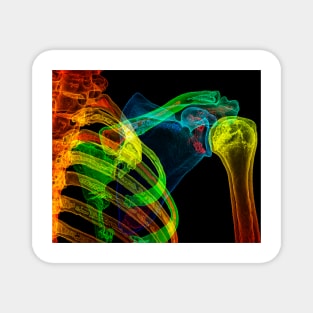 Normal shoulder, 3D CT scan (C029/5201) Magnet