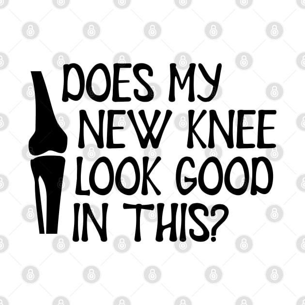 Knee Surgery - Does my new knee look go on this? by KC Happy Shop